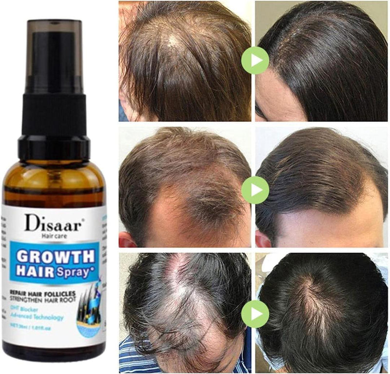 Product Name: Hair Growth Spray, 30 ml - Pack Of 3