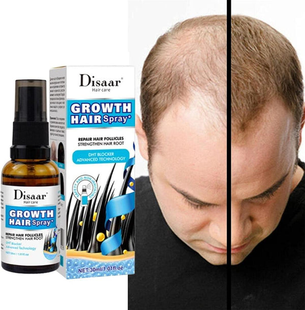 Product Name: Hair Growth Spray, 30 ml - Pack Of 3